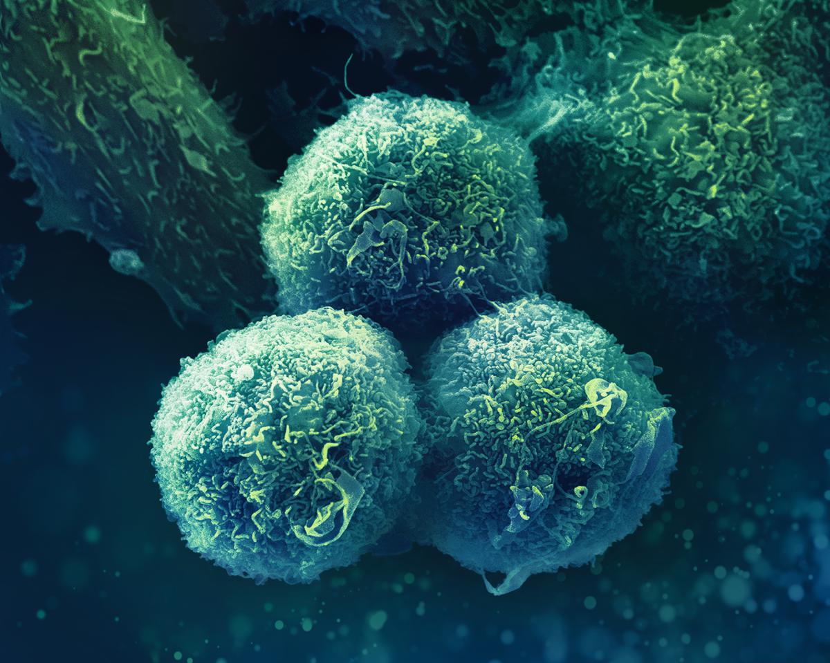 MSD Oncología - Cáncer